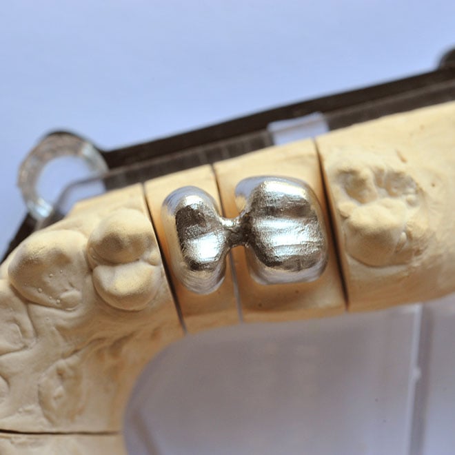 dental-welding-taumac